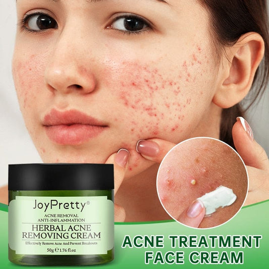 Acne Face Cream Herbal Pimple Scar Removal Shrink Pore Oil Moisturizing Treatmen