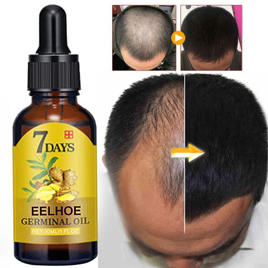 Fast Growing Hair Prevent Hair Loss Oil Scalp Treatment